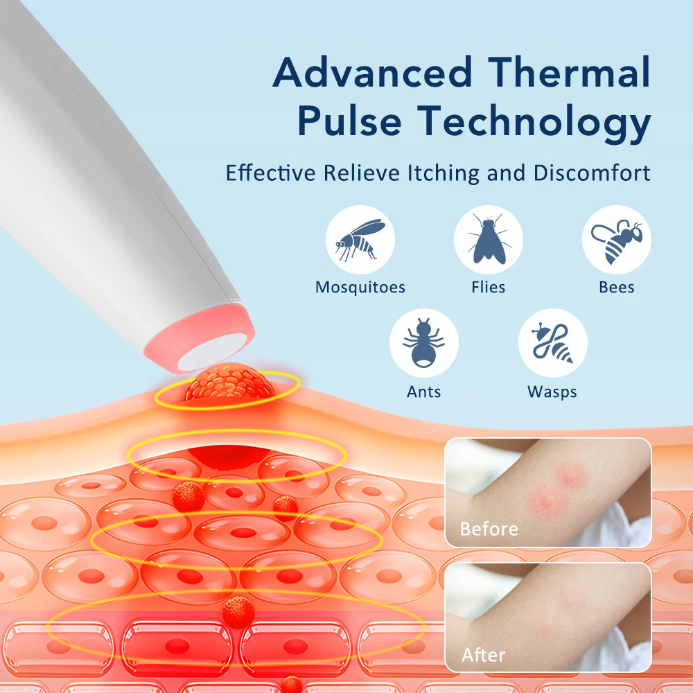 Portable Mosquito Bite Healer Pen, Chemical-Free Anti-Itch Heat Soother for Kids & Adults, Outdoor Bug Bite Treatment